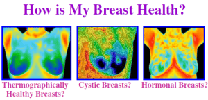 How is my breast health?